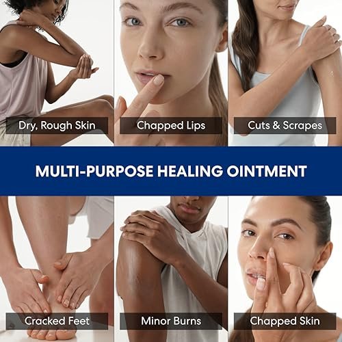 Palmer's Cocoa Butter Formula Healing Ointment mit Vitamin E, 3.75 Oz – Intensive Therapie für extrem trockene, zu Ekzemen neigende Haut, 48-Stunden-Feuchtigkeit, nicht komedogen, dermatologisch empfohlen