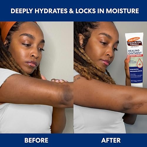 Palmer's Cocoa Butter Formula Healing Ointment mit Vitamin E, 3.75 Oz – Intensive Therapie für extrem trockene, zu Ekzemen neigende Haut, 48-Stunden-Feuchtigkeit, nicht komedogen, dermatologisch empfohlen