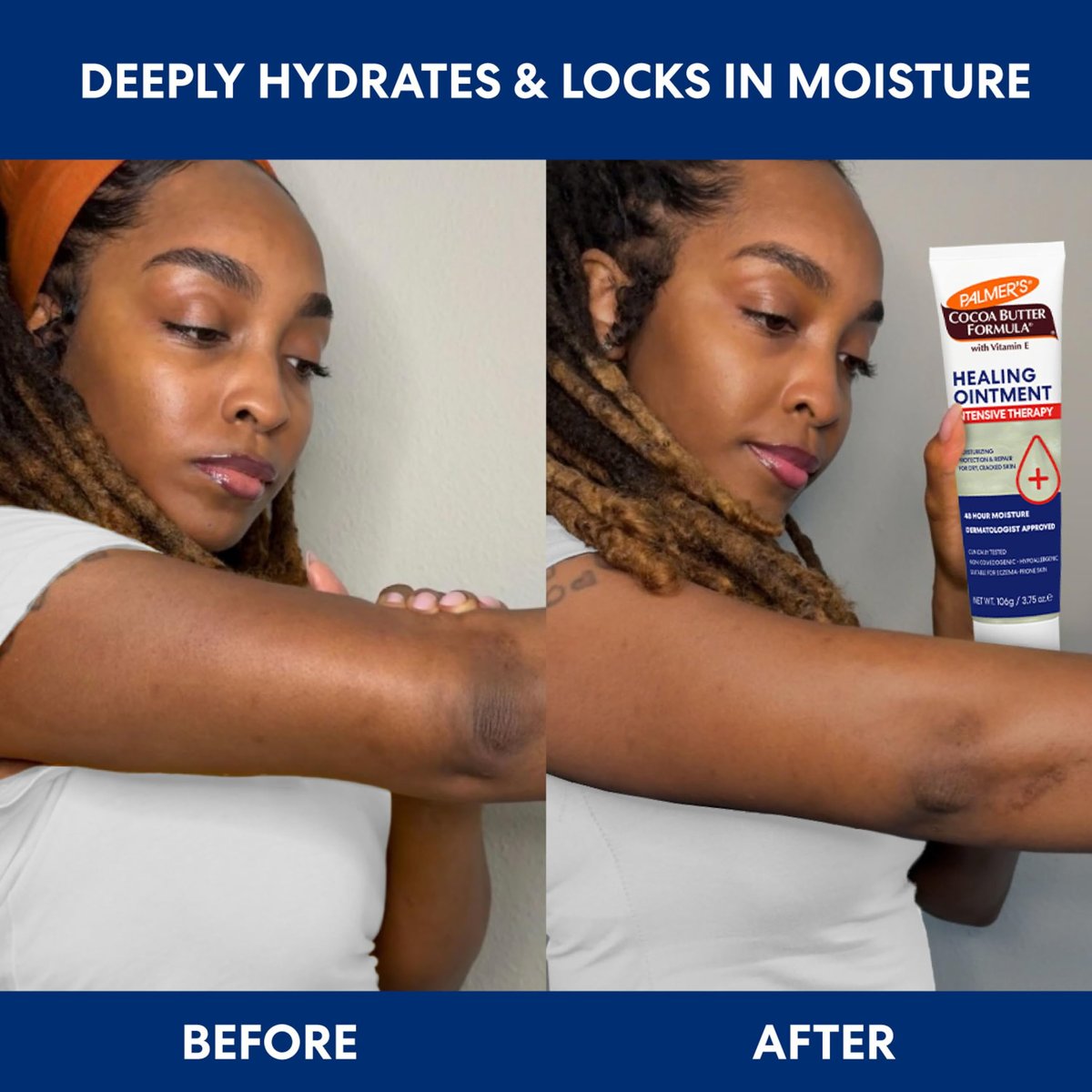 Palmer's Cocoa Butter Formula Healing Ointment mit Vitamin E, 3.75 Oz – Intensive Therapie für extrem trockene, zu Ekzemen neigende Haut, 48-Stunden-Feuchtigkeit, nicht komedogen, dermatologisch empfohlen