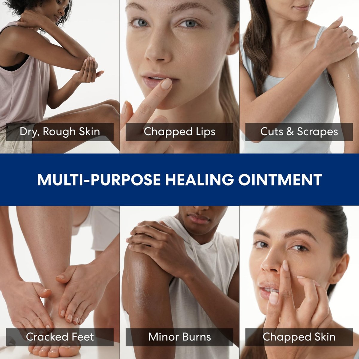 Palmer's Cocoa Butter Formula Healing Ointment mit Vitamin E, 3.75 Oz – Intensive Therapie für extrem trockene, zu Ekzemen neigende Haut, 48-Stunden-Feuchtigkeit, nicht komedogen, dermatologisch empfohlen