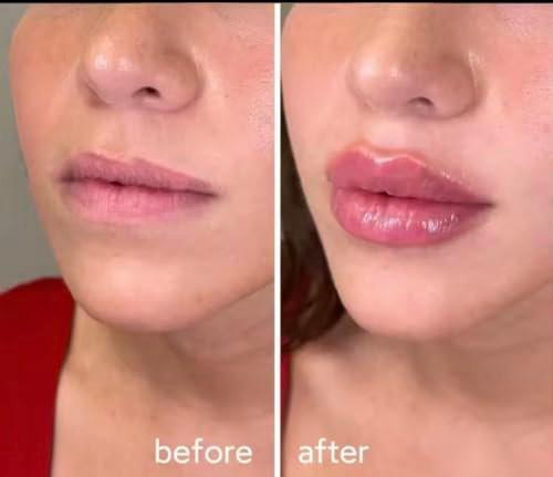Extreme Lip Plumping Lipgloss, Kräftiges Volumen & sofortiges Kribbeln, mit Kollagen, Hyaluronsäure und Vitamin E für weiche + volle Lippen (0,7 fl oz) Farbton - Kristallklar