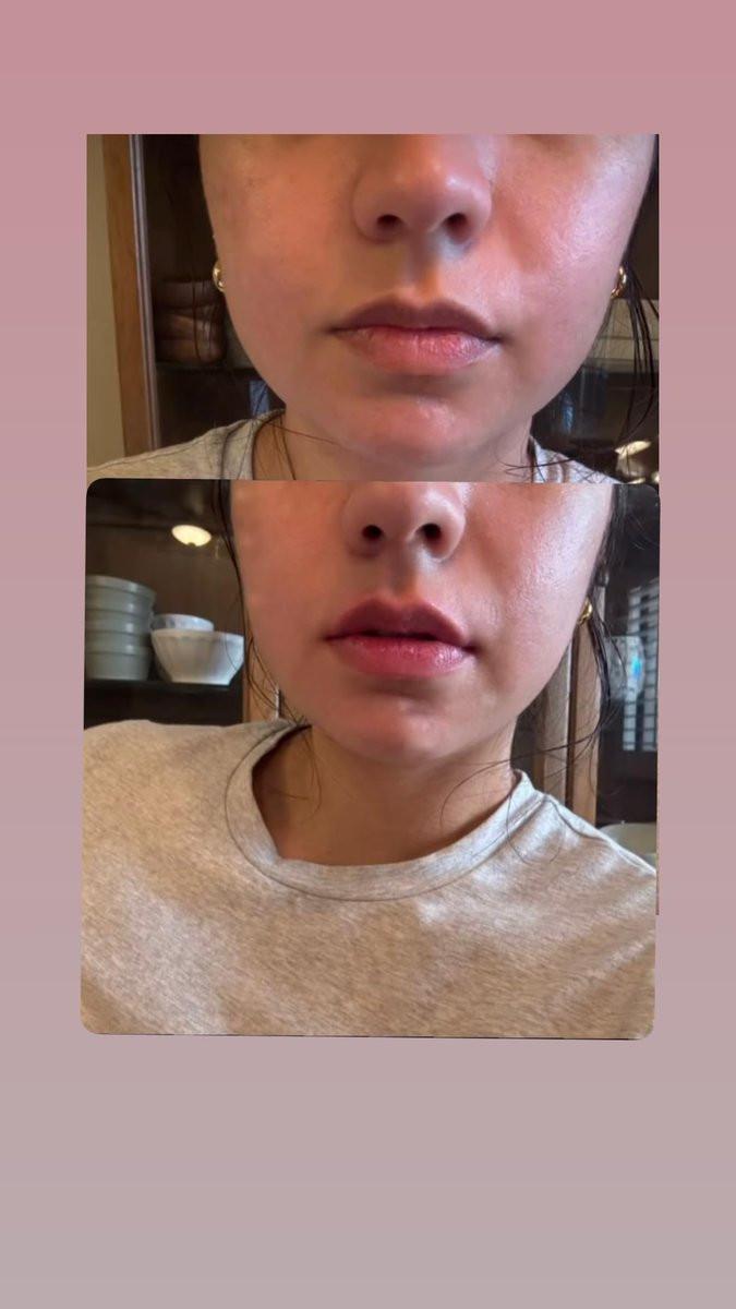 Extreme Lip Plumping Lipgloss, Kräftiges Volumen & sofortiges Kribbeln, mit Kollagen, Hyaluronsäure und Vitamin E für weiche + volle Lippen (0,7 fl oz) Farbton - Kristallklar