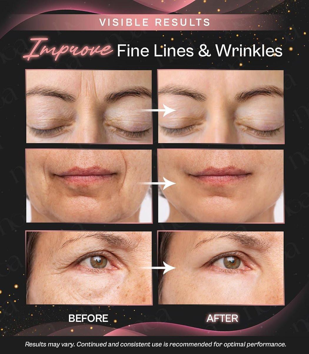 LuxeSkin 7-Farben-LED-Rotlicht-Therapie-Gesichtsmassagegerät für Gesicht und Hals, elektrisches Hautpflegegerät mit Vibration, Wärmemodus und Reisetasche