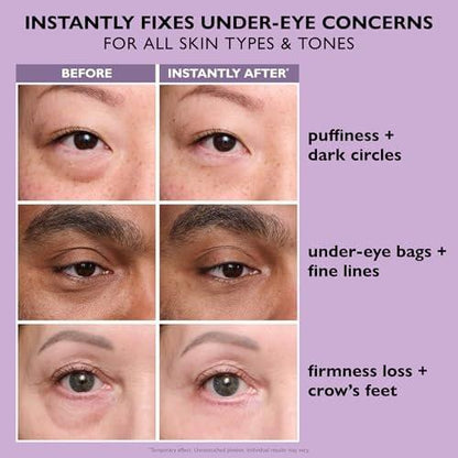 Peter Thomas Roth Instant FIRMx® Eye Temporary Eye Tightener Easy-Wear Formel – Strafft Tränensäcke und Fältchen unter den Augen