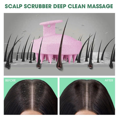 Hotosu Kopfhautmassagebürste für Haarwachstum – Silikon Kopfhautpeeling & Massagegerät – Manuelle Massagebürste für nasse und trockene Anwendung – Shampoo-Bürste (Pink)
