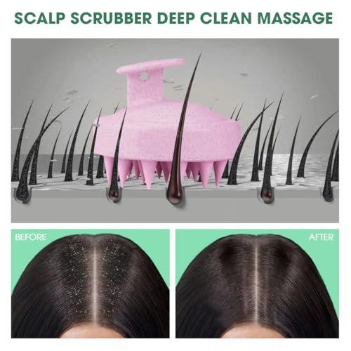 Hotosu Kopfhautmassagebürste für Haarwachstum – Silikon Kopfhautpeeling & Massagegerät – Manuelle Massagebürste für nasse und trockene Anwendung – Shampoo-Bürste (Pink)
