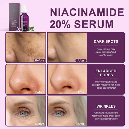 Bioglossy 20% Niacinamid Serum für das Gesicht – Konzentriertes Vitamin B3 & B5 Serum, Feuchtigkeitsspender, Porenverfeinerer, Anti-Aging Behandlung gegen Verfärbungen