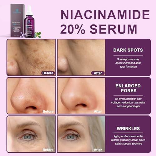 Bioglossy 20% Niacinamid Serum für das Gesicht – Konzentriertes Vitamin B3 & B5 Serum, Feuchtigkeitsspender, Porenverfeinerer, Anti-Aging Behandlung gegen Verfärbungen