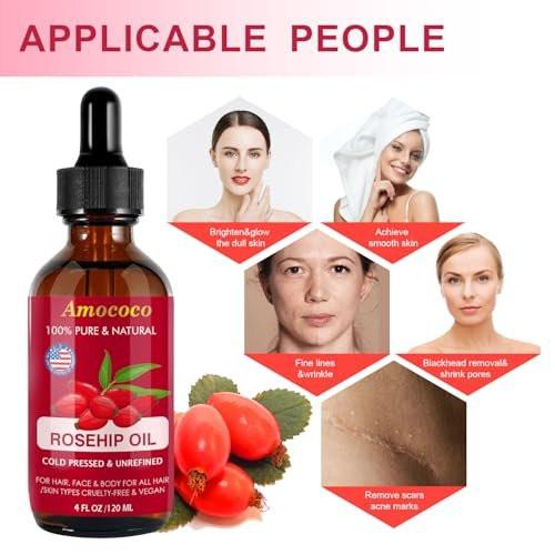 Amococo Bio Kaltgepresstes Rosenöl für das Gesicht, Natürliches Rosenkernöl, Nährstoffreiches Gesichtsserum zur Hautpflege, Feuchtigkeitsspender für trockene Haut, 118 ml