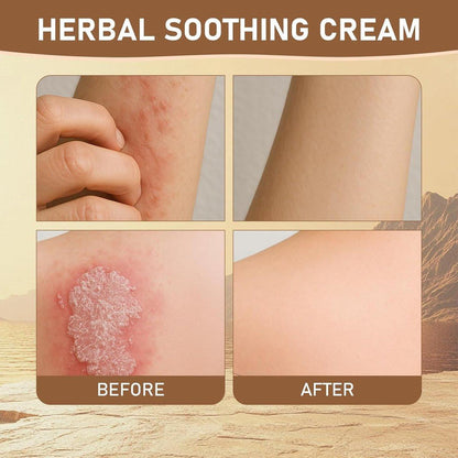 Rulinal Kräuter-Beruhigungscreme - Antibakterielle Naturcreme gegen Psoriasis, Ekzeme & Hautprobleme - 85g