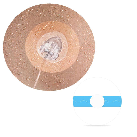 30 Stück wasserdichte Infusionsstellen-Pflaster für CGM-Sensoren, kompatibel mit Medtronic 780G/770G, Tandem t:Slim X2/Mobi – hypoallergene Klebepflaster mit 0,8 Zoll Loch, 14 Tage Tragedauer, vorgeschnittene atmungsaktive transparente Pflaster