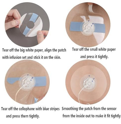 30 Stück wasserdichte Infusionsstellen-Pflaster für CGM-Sensoren, kompatibel mit Medtronic 780G/770G, Tandem t:Slim X2/Mobi – hypoallergene Klebepflaster mit 0,8 Zoll Loch, 14 Tage Tragedauer, vorgeschnittene atmungsaktive transparente Pflaster