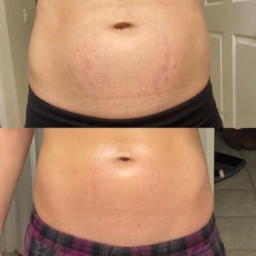 2er-Pack Brazilian Body Firming Cream | Fortschrittliche Lift- & Straffungsformel | Reduziert sichtbar Cellulite & Dehnungsstreifen | Intensive Feuchtigkeitspflege für Beine, Arme & Körper | Wertbundle 8 oz pro Tube