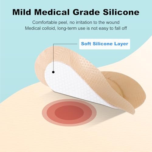 Sakraler Schaumverband, Silikon-Schaumverband mit Rand, 7x7 große Wundauflage für Druckgeschwüre am Gesäß, superabsorbierendes Druckgeschwür-Präventionspad, wasserdicht & atmungsaktiv (10er-Pack)