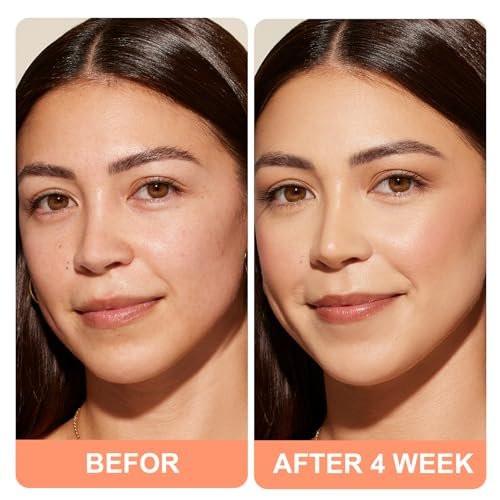 Triple Power Anti-Aging Feuchtigkeitscreme – Retinol, Hyaluronsäure, Vitamin C, Niacinamid – Faltreduktion, Straffung, Aufhellung & Tiefenhydratation für jünger aussehende Haut, 1,7 Unzen