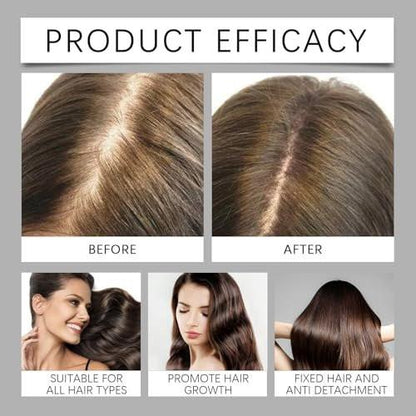 Qiuumey Haar-Serum Bundle – Behandlung gegen Haarausfall mit pflanzlichen Wirkstoffen, Prävention & Behandlung, Kopfhaut-Serum-Set für Männer & Frauen, sulfatfrei, 2 x 30 ml