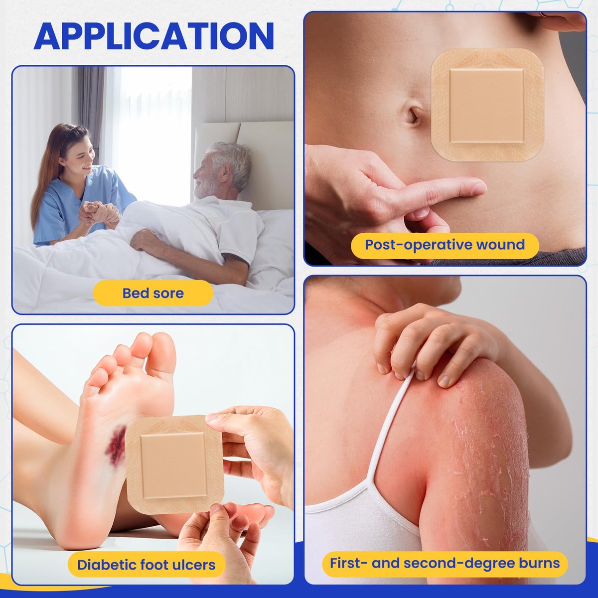 10er-Pack Silikon-Schaumstoff-Wundverband 10x10 cm mit Kleberand, hochsaugfähige Silikon-Bandagen, wasserdichte Schaumstoff-Pflaster für Wundversorgung, Druckgeschwüre, diabetische Fußgeschwüre
