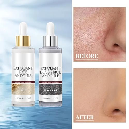 Schwarz-Weiß-Reis-Peeling, neues sanftes Reis-Exfoliant für Gesicht und Körper, Schwarz-Weiß-Reis-Peeling für alle Hauttypen, sanftes Peeling & tiefe Feuchtigkeitsversorgung (Weiß+Schwarz) 2 Stück
