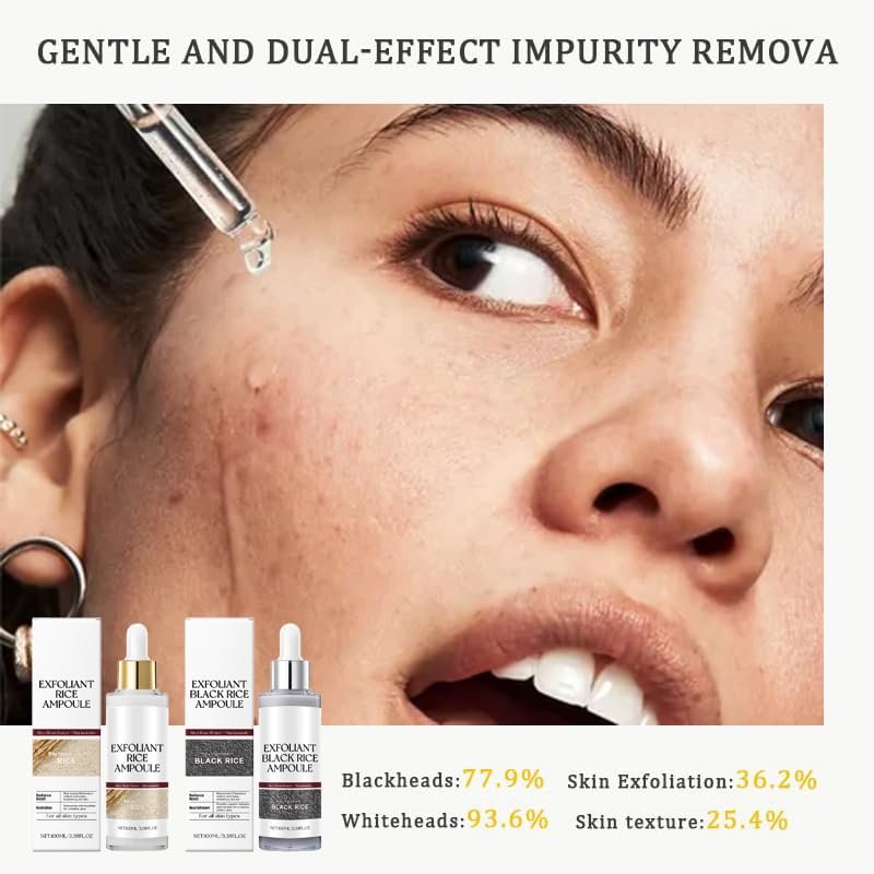 Schwarz-Weiß-Reis-Peeling, neues sanftes Reis-Exfoliant für Gesicht und Körper, Schwarz-Weiß-Reis-Peeling für alle Hauttypen, sanftes Peeling & tiefe Feuchtigkeitsversorgung (Weiß+Schwarz) 2 Stück