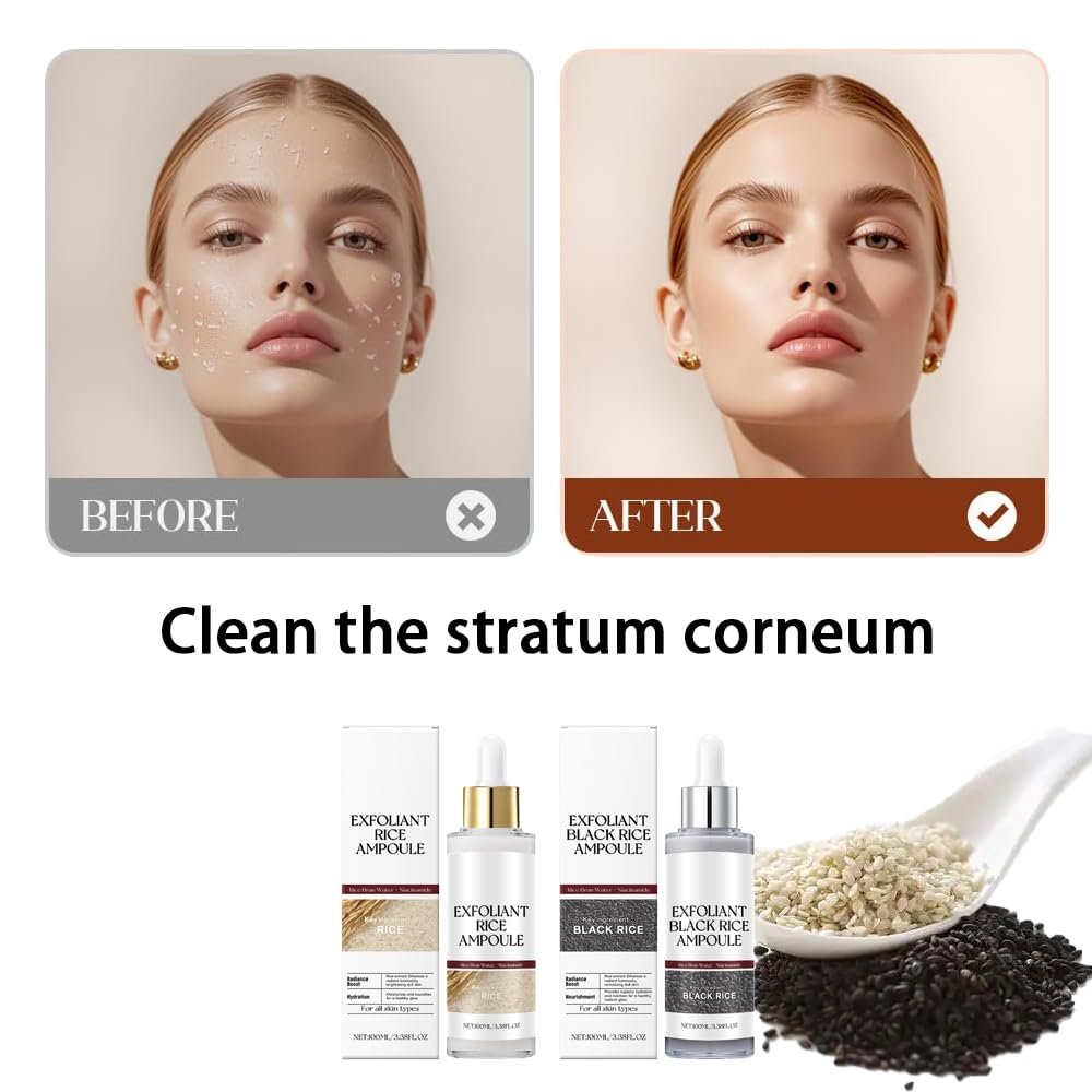 Schwarz-Weiß-Reis-Peeling, neues sanftes Reis-Exfoliant für Gesicht und Körper, Schwarz-Weiß-Reis-Peeling für alle Hauttypen, sanftes Peeling & tiefe Feuchtigkeitsversorgung (Weiß+Schwarz) 2 Stück