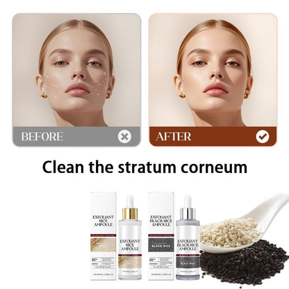 Schwarz-Weiß-Reis-Peeling, neues sanftes Reis-Exfoliant für Gesicht und Körper, Schwarz-Weiß-Reis-Peeling für alle Hauttypen, sanftes Peeling & tiefe Feuchtigkeitsversorgung (Weiß+Schwarz) 2 Stück