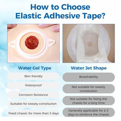 Sunliech 20 Stück Elastische Ostomy Barrier Strips, Medizinische Hydrokolloid-Ostomy-Versorgung, Hautklebendes Ostomy-Barrier-Tape, Wasserdicht gegen Leckagen für Ostomy-Beutel, Colostomie- und Ileostomie-Zubehör