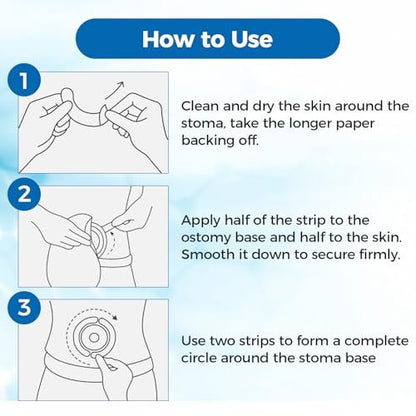 Sunliech 20 Stück Elastische Ostomy Barrier Strips, Medizinische Hydrokolloid-Ostomy-Versorgung, Hautklebendes Ostomy-Barrier-Tape, Wasserdicht gegen Leckagen für Ostomy-Beutel, Colostomie- und Ileostomie-Zubehör