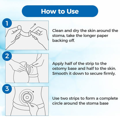 Sunliech 20 Stück Elastische Ostomy Barrier Strips, Medizinische Hydrokolloid-Ostomy-Versorgung, Hautklebendes Ostomy-Barrier-Tape, Wasserdicht gegen Leckagen für Ostomy-Beutel, Colostomie- und Ileostomie-Zubehör
