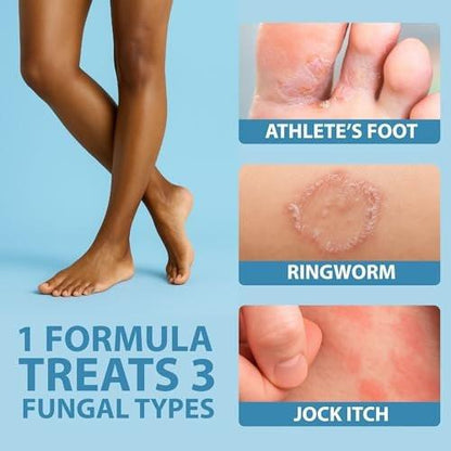 Curist Terbinafin Creme 1% – Antimykotische Fußpilzbehandlung, 30 g (1 Unze) – Gegen Fußpilz, Ringelflechte & Jock Itch