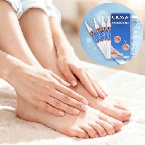 CHUNY Extra Stärke Nagelreparatur-Stift – 4 Nagelöl-Cuticle-Pens mit natürlichen Pflanzenextrakten zur Reparatur von verfärbten, brüchigen und beschädigten Fußnägeln – Effektive Nagelreparaturlösung