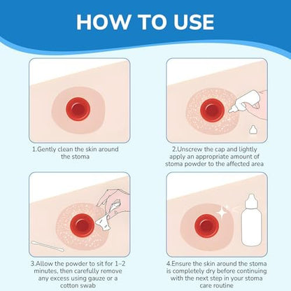 Heagimed Stoma-Puder – Hautschutzbarriere & Haftpuder für Stomaversorgung, 25 g