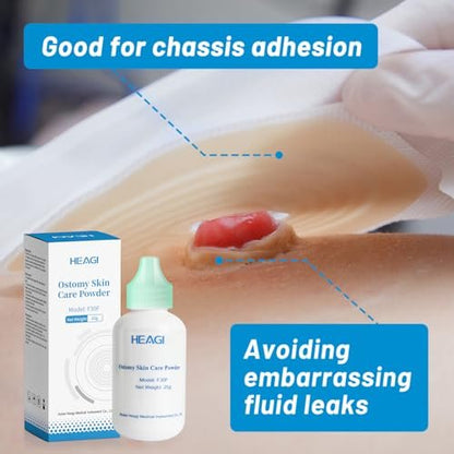 Heagimed Stoma-Puder – Hautschutzbarriere & Haftpuder für Stomaversorgung, 25 g
