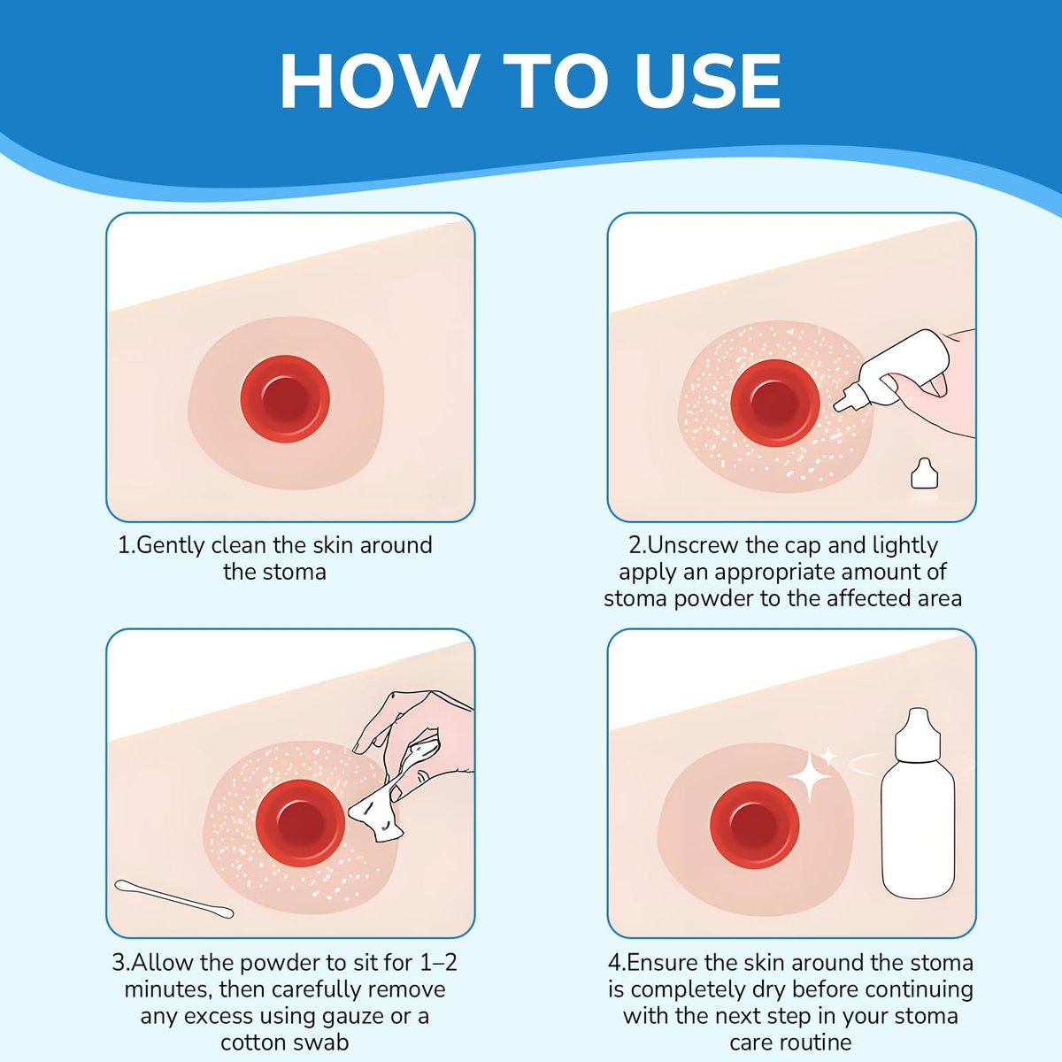 Heagimed Stoma-Puder – Hautschutzbarriere & Haftpuder für Stomaversorgung, 25 g