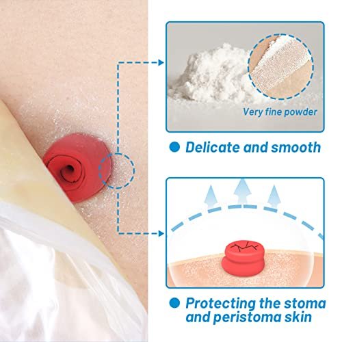 Heagimed Stoma-Puder – Hautschutzbarriere & Haftpuder für Stomaversorgung, 25 g