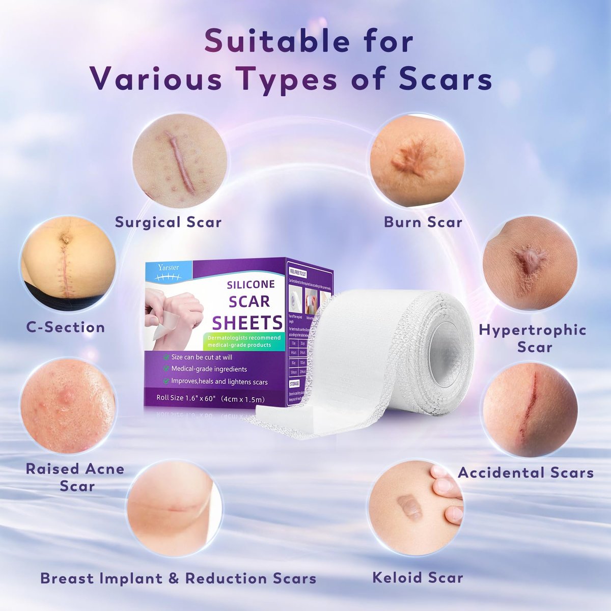 Yarster Medizinisches Silikonpflaster für Narben – Silikon-Narbenband (1,6 Zoll x 60 Zoll Rolle – 1,5 m) – Wiederverwendbar bei Operationsnarben, Verbrennungen, Kaiserschnitt, Keloiden und Akne