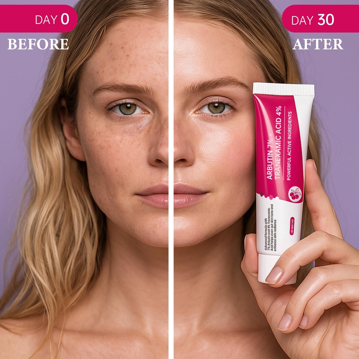 EELHOE Arbutin 7% + Tranexamsäure 4% Creme – 70.000 ppm Arbutin & 40.000 ppm TXA – Feuchtigkeitsspendend, ebenmäßiger Hautton, reduziert dunkle Flecken & Pigmentierung, 50 ml