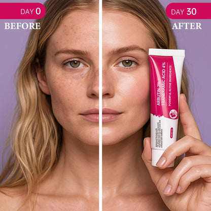 EELHOE Arbutin 7% + Tranexamsäure 4% Creme – 70.000 ppm Arbutin & 40.000 ppm TXA – Feuchtigkeitsspendend, ebenmäßiger Hautton, reduziert dunkle Flecken & Pigmentierung, 50 ml
