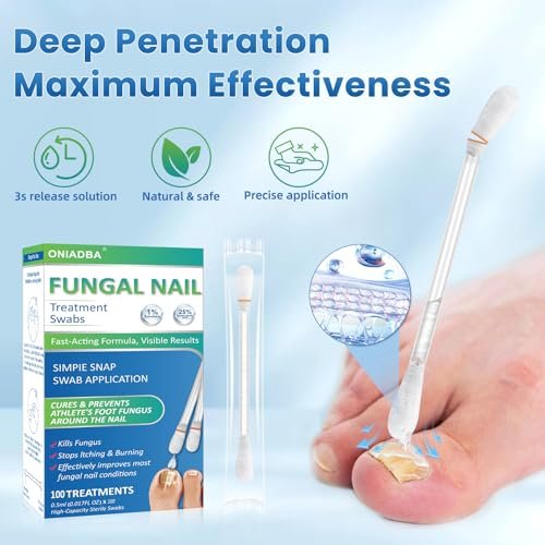 Fußnagelpilz-Behandlungstücher – 100 Stück, extra starke Zehennagel- & Fußpilzbehandlung mit 25% Undecylensäure, beschädigte, verfärbte & dicke Nägel, stellt gesundes Nagelwachstum wieder her