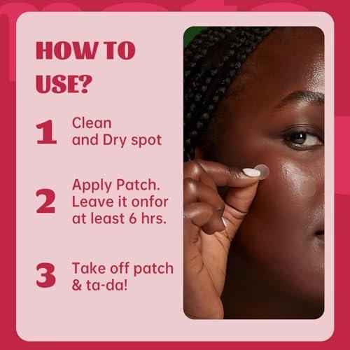 Pimple Patches für Gesicht/Nase, 3 Größen, 194 Stück Hydrokolloid-Akne-Pflaster mit Salicylsäure, Teebaumöl & Ringelblumenöl