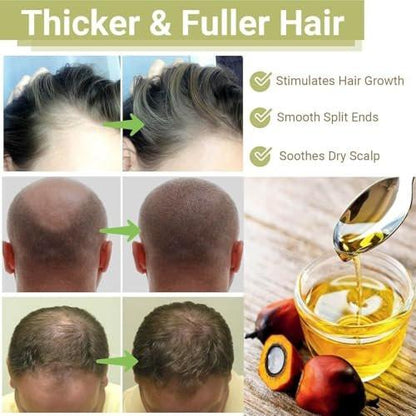 Lifewitqueenp Haarwuchsöl – Ayurvedisches Haaröl für alle Haartypen, leichtes Pflegeöl (1 Flasche)