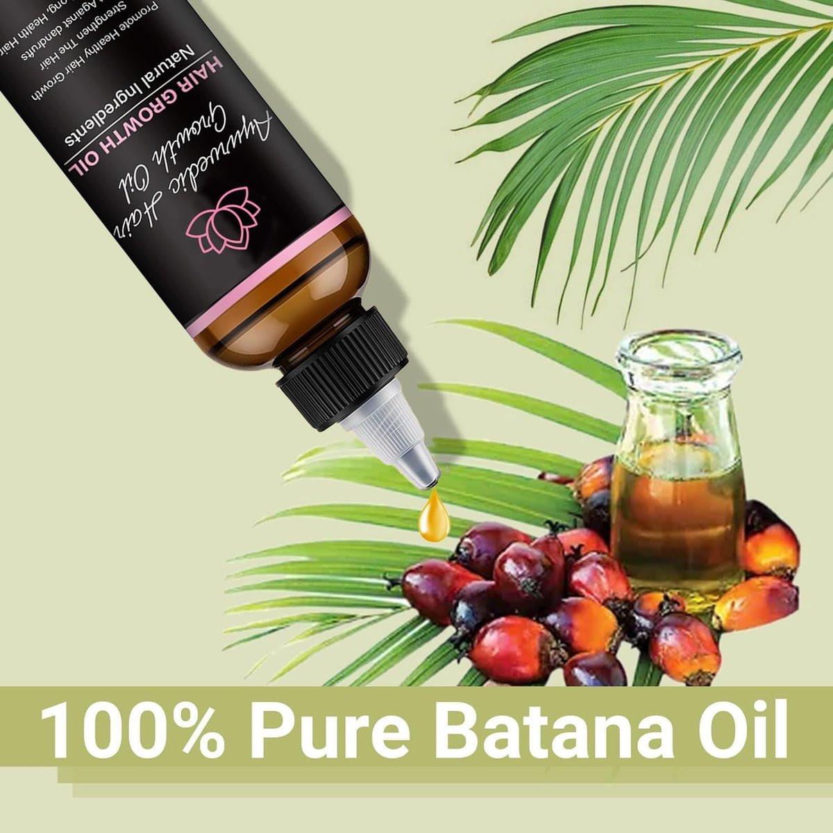 Lifewitqueenp Haarwuchsöl – Ayurvedisches Haaröl für alle Haartypen, leichtes Pflegeöl (1 Flasche)
