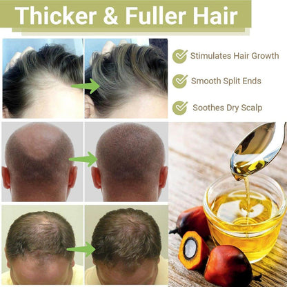 Lifewitqueenp Haarwuchsöl – Ayurvedisches Haaröl für alle Haartypen, leichtes Pflegeöl (1 Flasche)