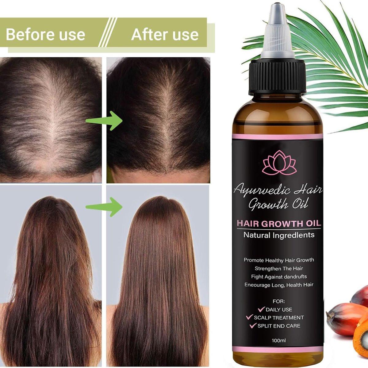 Lifewitqueenp Haarwuchsöl – Ayurvedisches Haaröl für alle Haartypen, leichtes Pflegeöl (1 Flasche)