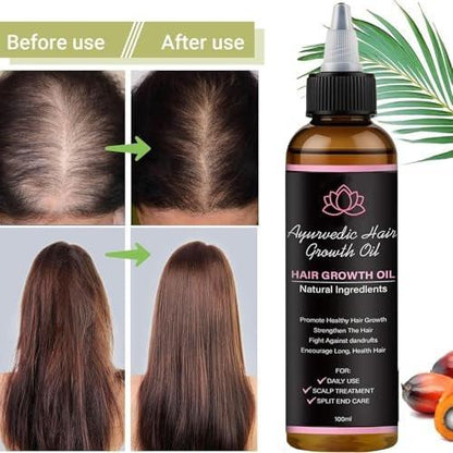 Lifewitqueenp Haarwuchsöl – Ayurvedisches Haaröl für alle Haartypen, leichtes Pflegeöl (1 Flasche)