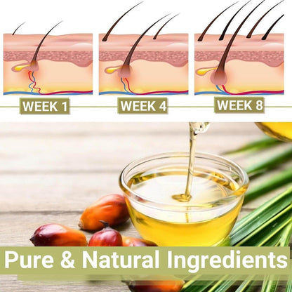 Lifewitqueenp Haarwuchsöl – Ayurvedisches Haaröl für alle Haartypen, leichtes Pflegeöl (1 Flasche)