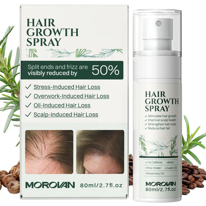 Morovan Haarwuchsspray für die Kopfhaut: 30 Tage Reduzierung von Haarausfall & Haarwachstum mit Batana- und Rizinusöl für dünner werdendes Haar, geschädigtes Haar & starken Haarausfall - 80 ml