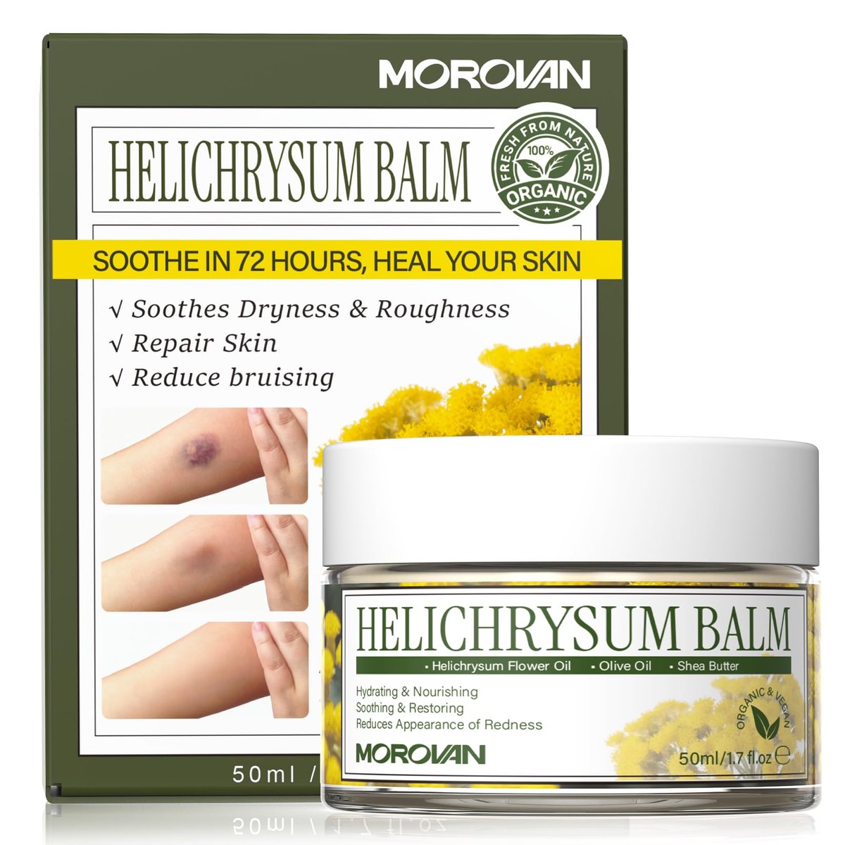 Morovan Alters-Hämatom-Balsam mit Helichrysum: Mehrzweck-Hautbalsam für Blutergüsse, Venen, Verbrennungen & Rötungen durch Aktivität & Alterung, Fördert Heilung & Durchblutung für Männer & Frauen