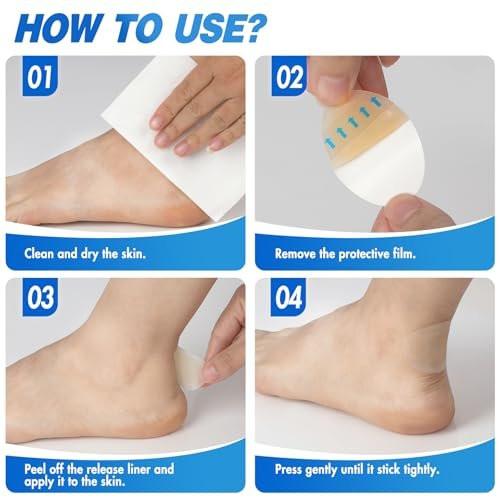 Arme Hydrokolloid-Bandagen für Blasen an den Füßen, 50 Stück Gel-Blisterpflaster, wasserdichte Blasenpflaster, Schutz & Heilung, 4 Formen (Sortiment)