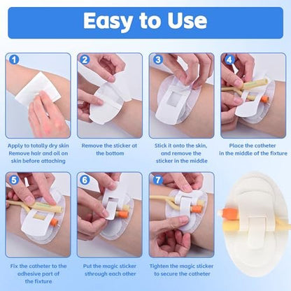 12 Stück Katheterfixierungspflaster, Foley-Katheter-Zubehör, Beinbeutel-Halter-Aufkleber, selbstklebender Katheterschlauchhalter für PEG/Sonden/Ernährungssonden (Weiß)