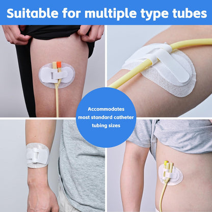 12 Stück Katheterfixierungspflaster, Foley-Katheter-Zubehör, Beinbeutel-Halter-Aufkleber, selbstklebender Katheterschlauchhalter für PEG/Sonden/Ernährungssonden (Weiß)